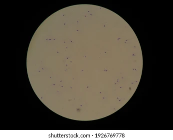 <p>What magnification level are the Sperm Cells? </p>