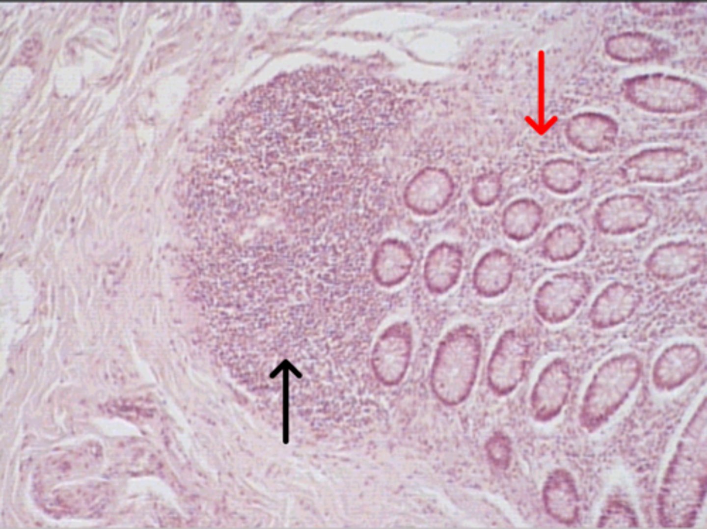 <p>black arrow</p><p>B lymphocytes</p>