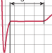 <p>follows ventricular depolarization + occurs prior to the start of ventricular repolarization&nbsp;</p>