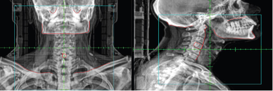 <p>What type of image is this?</p>