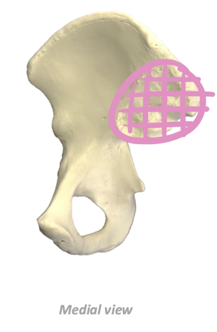 term image