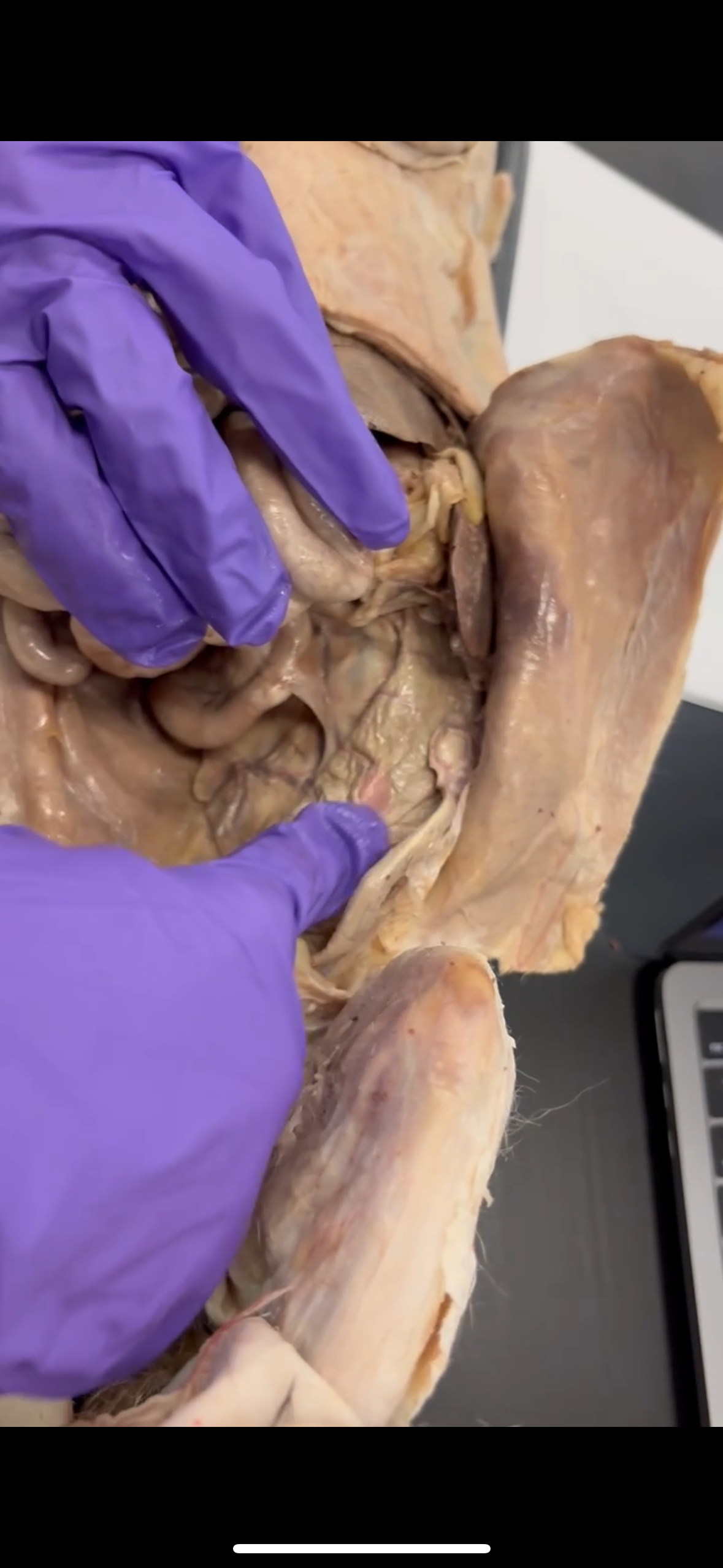 <p>What structure and part </p>