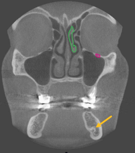<p>where is this slice located </p>
