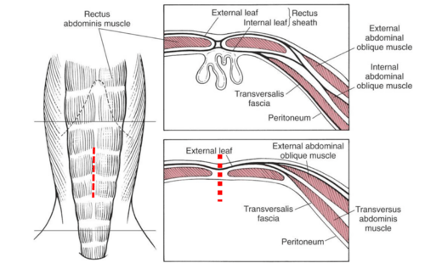 <p>what layers are you cutting through and closing (ideally) when performing a spay</p>
