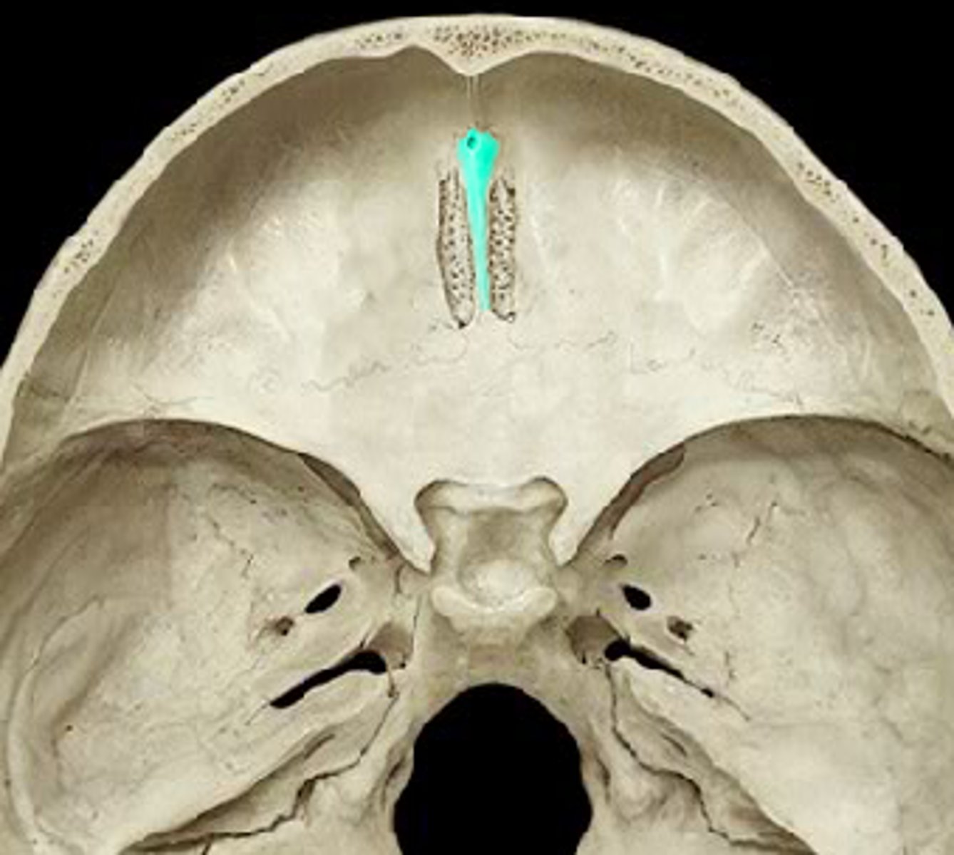 knowt flashcard image