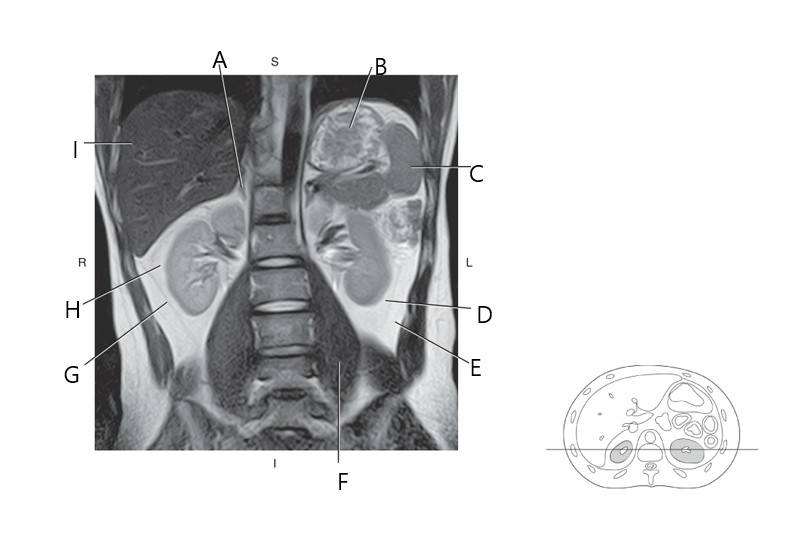 <p>Posterior para renal</p>