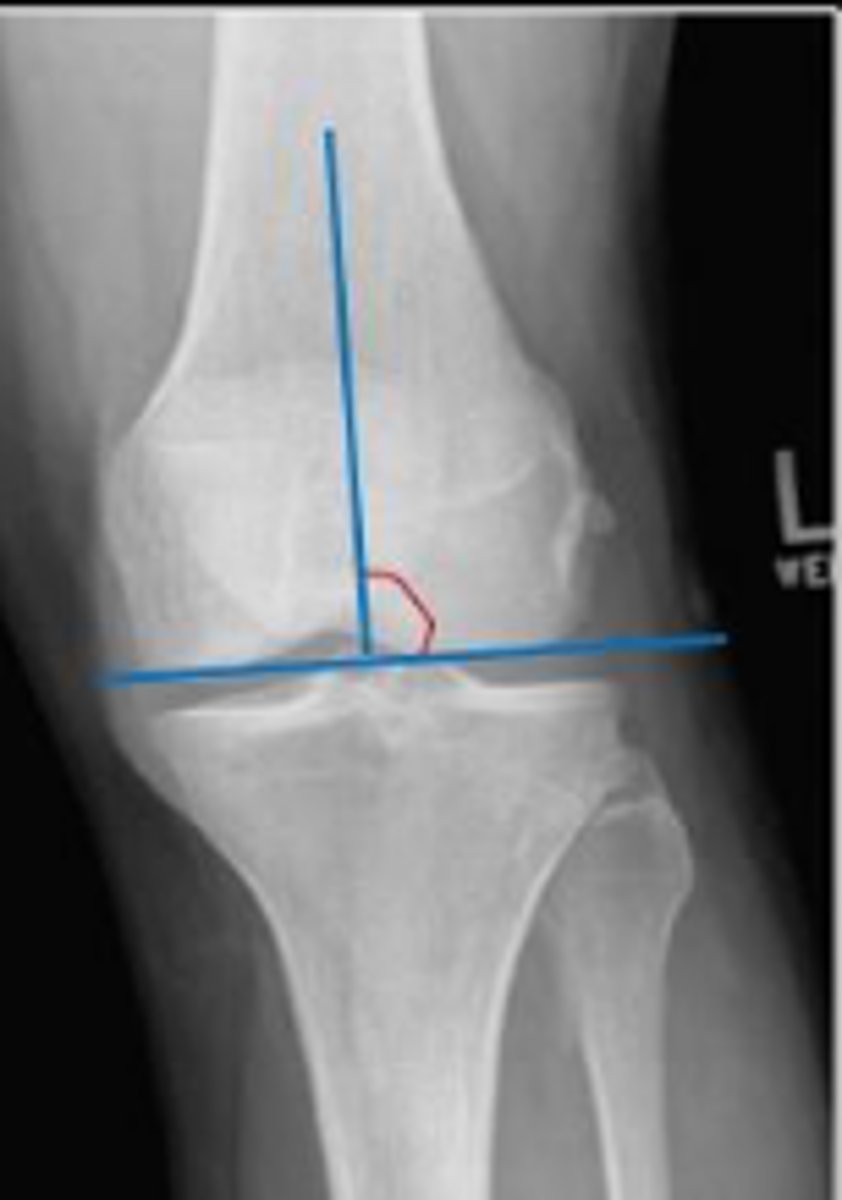 <p>What is the name of the assessment?</p>