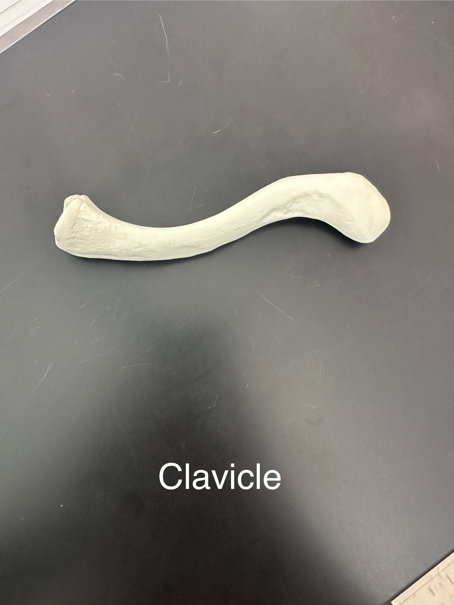 <p>Clavicle</p>