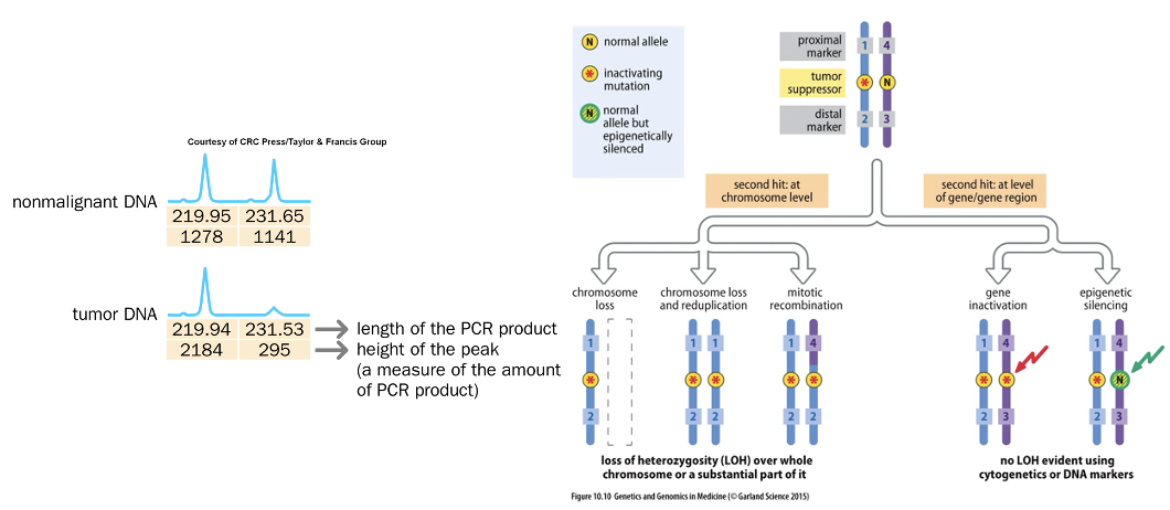 <p>refers to the additional genetic alteration that occurs after the first mutation in a tumor suppressor gene, essential for tumor development. </p>