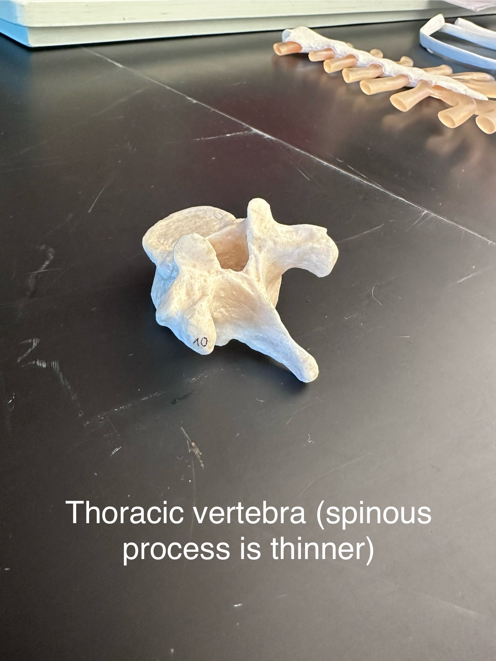 <p>Thoracic vertebra: you can tell by knowing the spinous process is thinner</p>