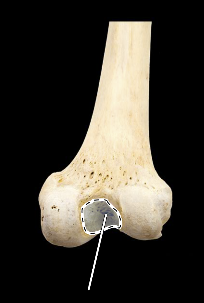 <p>Name the highlighted portion.</p><p>(Posterior view, right side).</p>