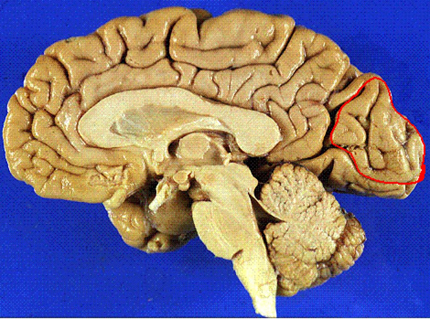 <p>wedge shaped lobe on occipital lobe</p><p>-bw parietoccipital and calcarine sulci</p>