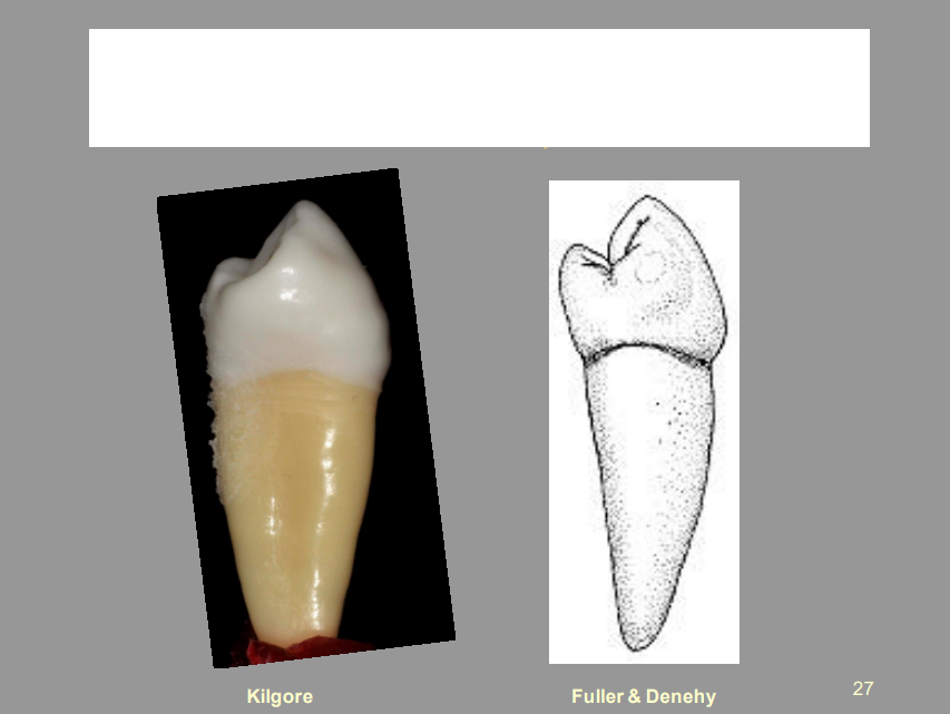 <p>From the Picture Shown, What Tooth Is This, And What View?</p>