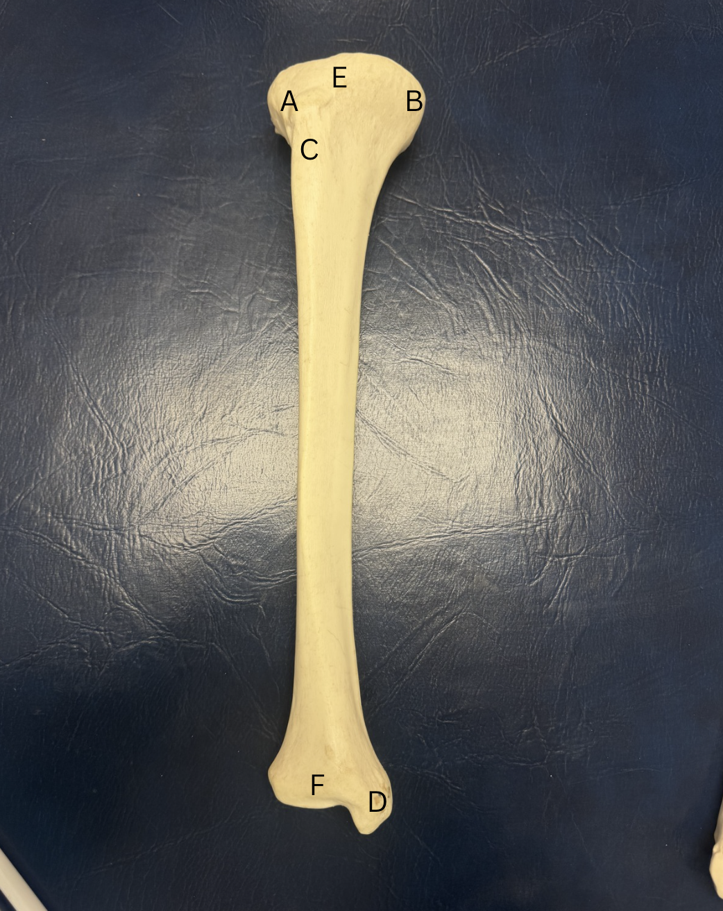 <p>Label A-F of this bone</p>
