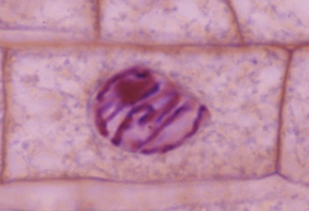 <p>Prophase</p>