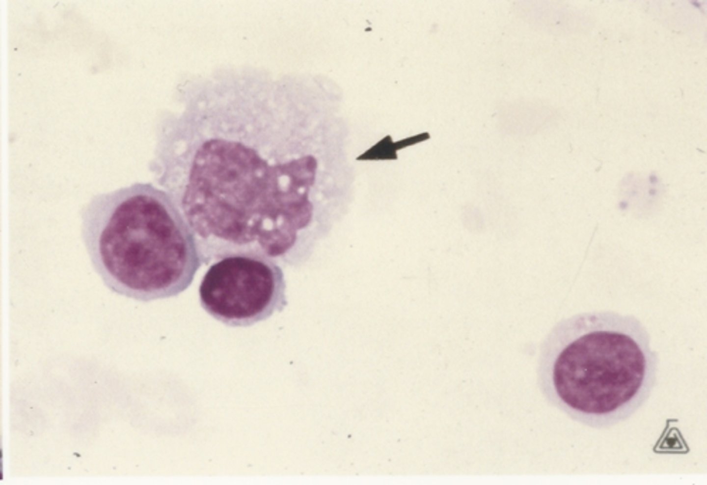 <p>Identify the cells in this body fluid</p>