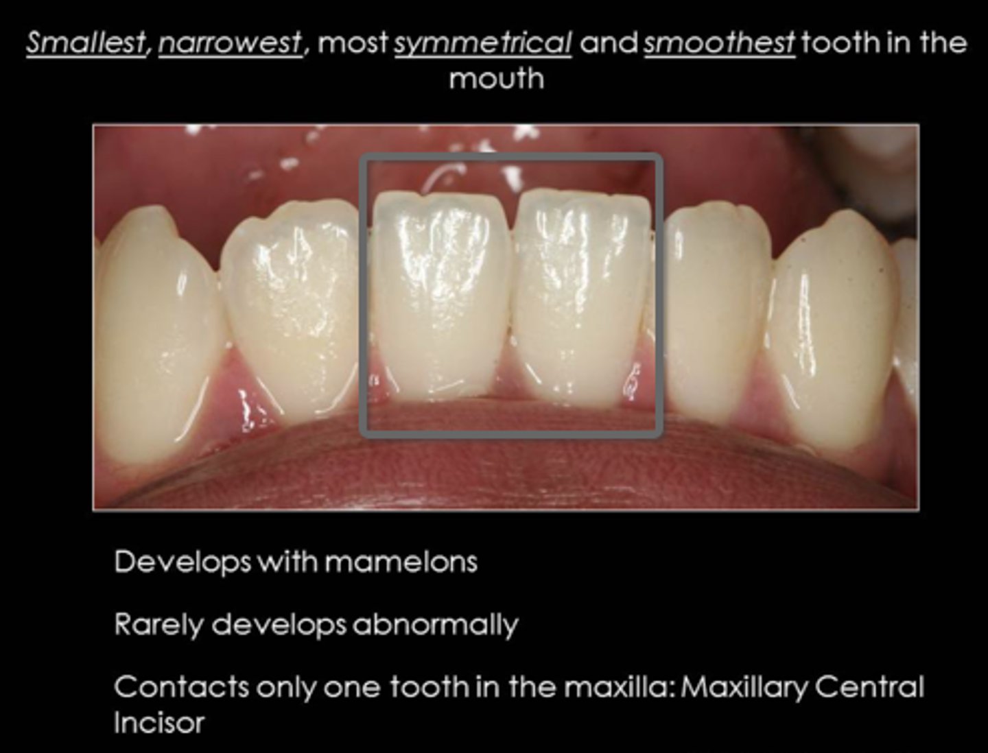<p>Mandibular central incisor</p>