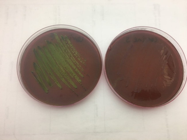 <p>is the right or left positive for E.coli?</p>