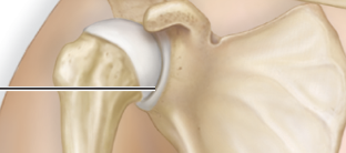 <p>connects scapula and humerus</p>