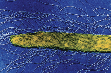 <p>Flagella all over surface</p>