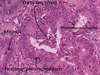 term image