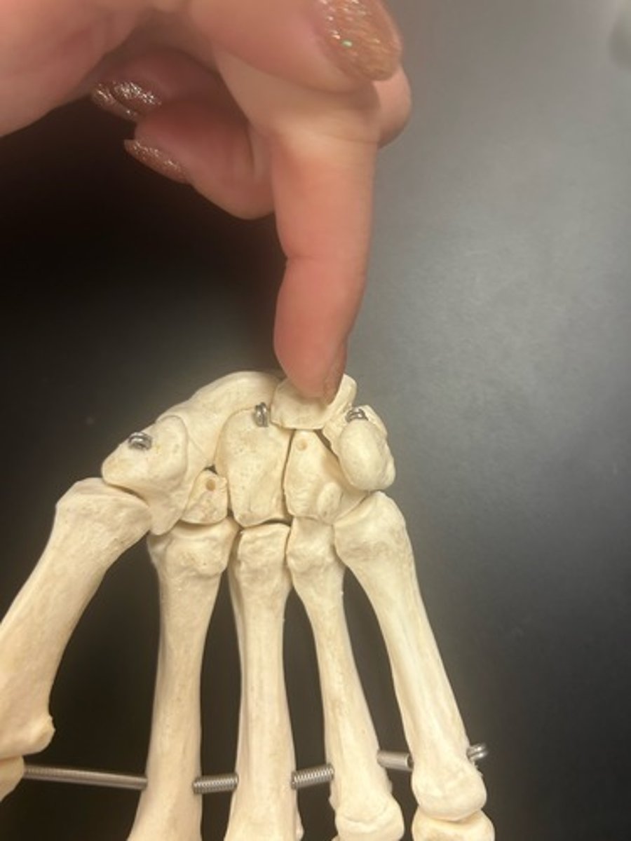 <p>name the bone</p>