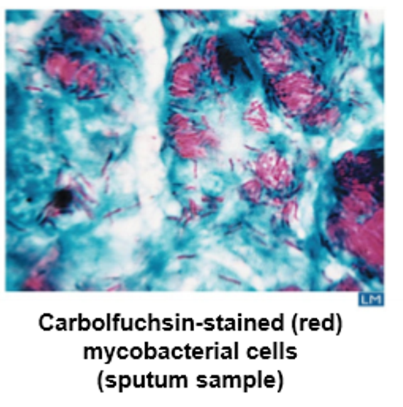 <ul><li><p>Carbolfuschin (red)</p></li><li><p>unlike gram (+) contains 60&amp; lipid (<strong>mycolic acid</strong>) and less peptidoglycan - waxy&nbsp;prevents them from being stained</p></li><li><p>so they are hard to stain, but don’t get discoulored by alcohol</p></li></ul><p></p>