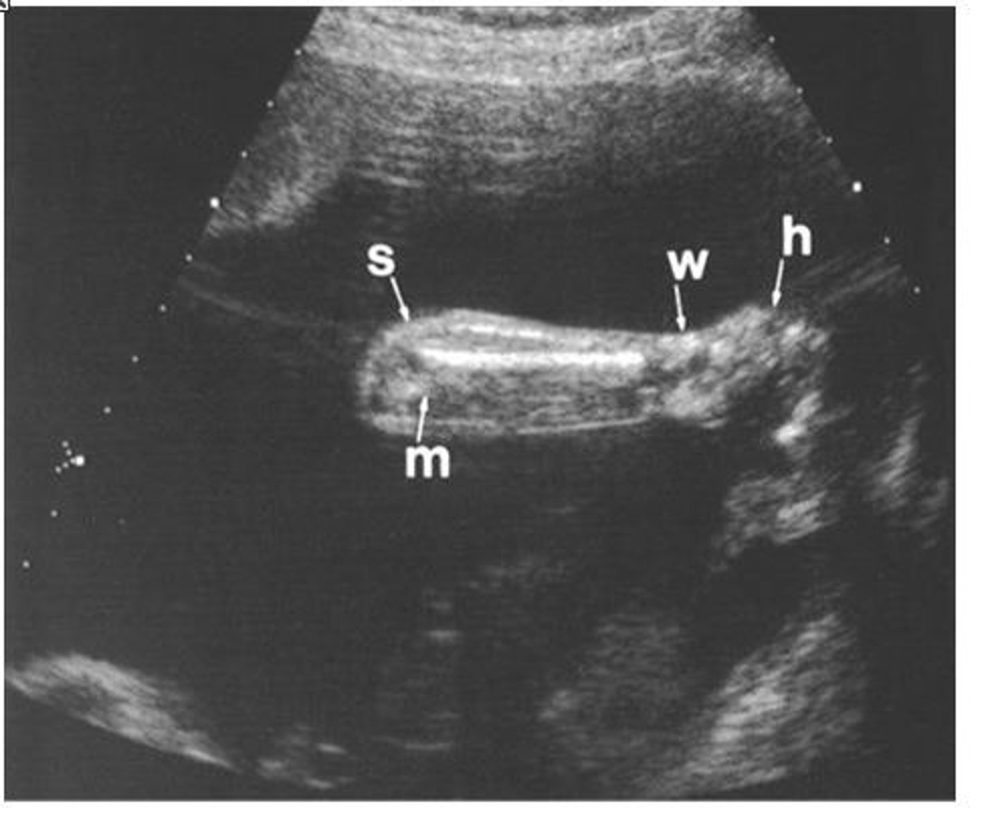 <p>process of recording with sound of the pelvic cavity</p>