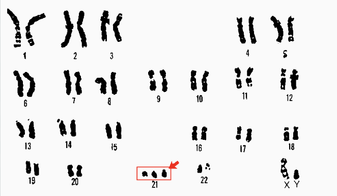 <p>It is a chromosomal mutation where an organism has extra or missing chromosomes</p>