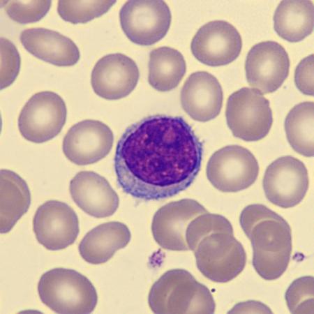 <p>What is this leukocyte?</p>
