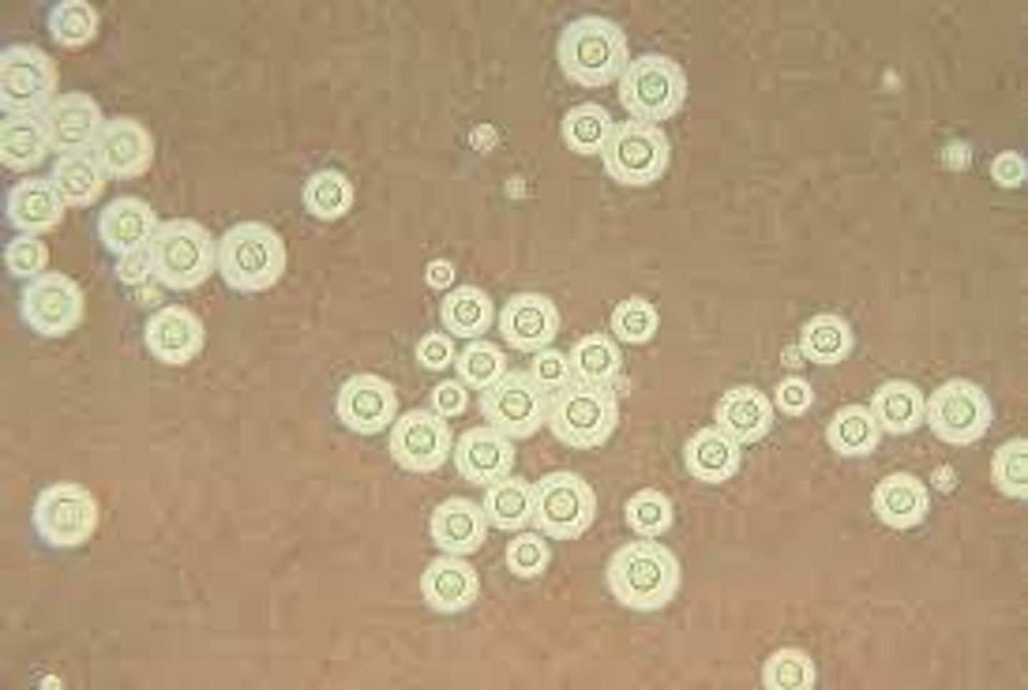 <p>B: cryptococcus neoformans</p><p>Positive india ink stain shows yeast cells with a surrounding clear area. see image</p><p>reference: CLS review book</p>