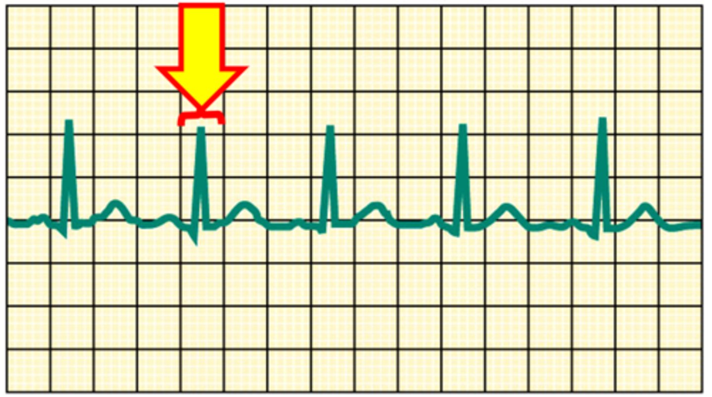 <p>Name the structure</p>