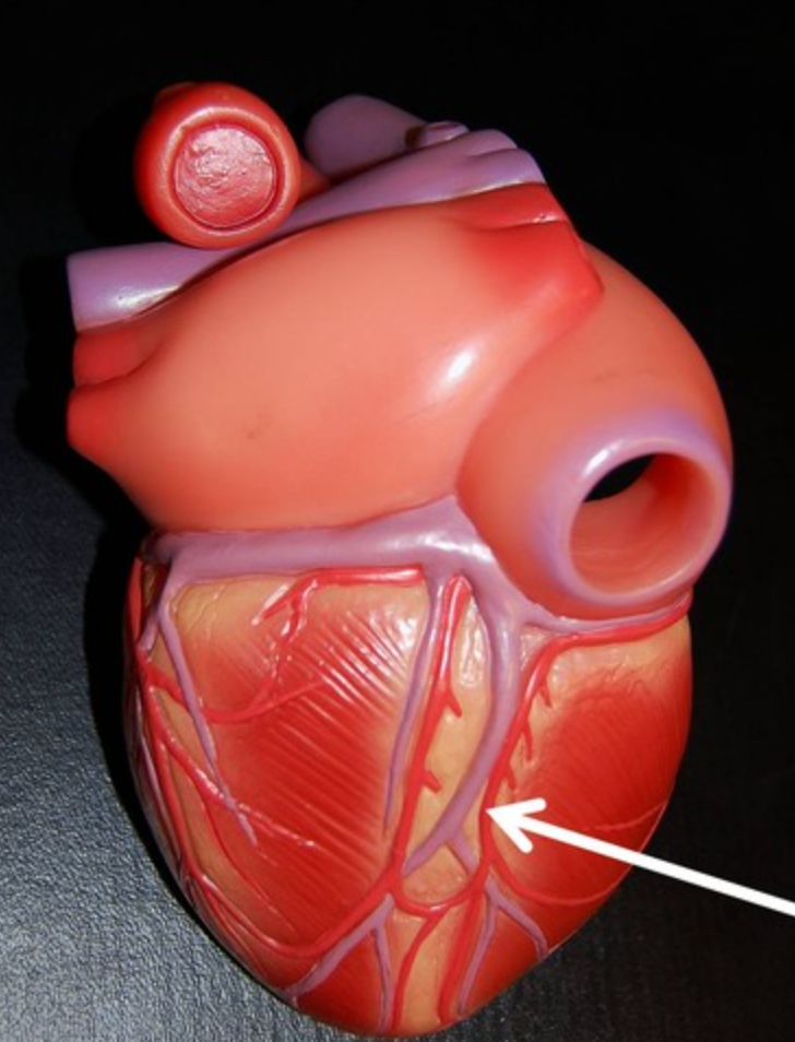 <p>Inferior wall. feeds back side of heart.</p>