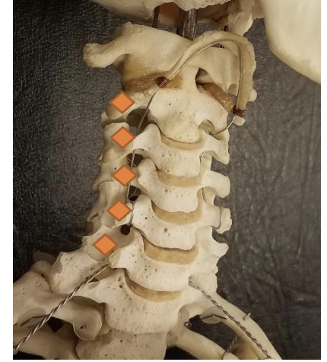 <p>anterolateral transverse processes of C2-6</p>