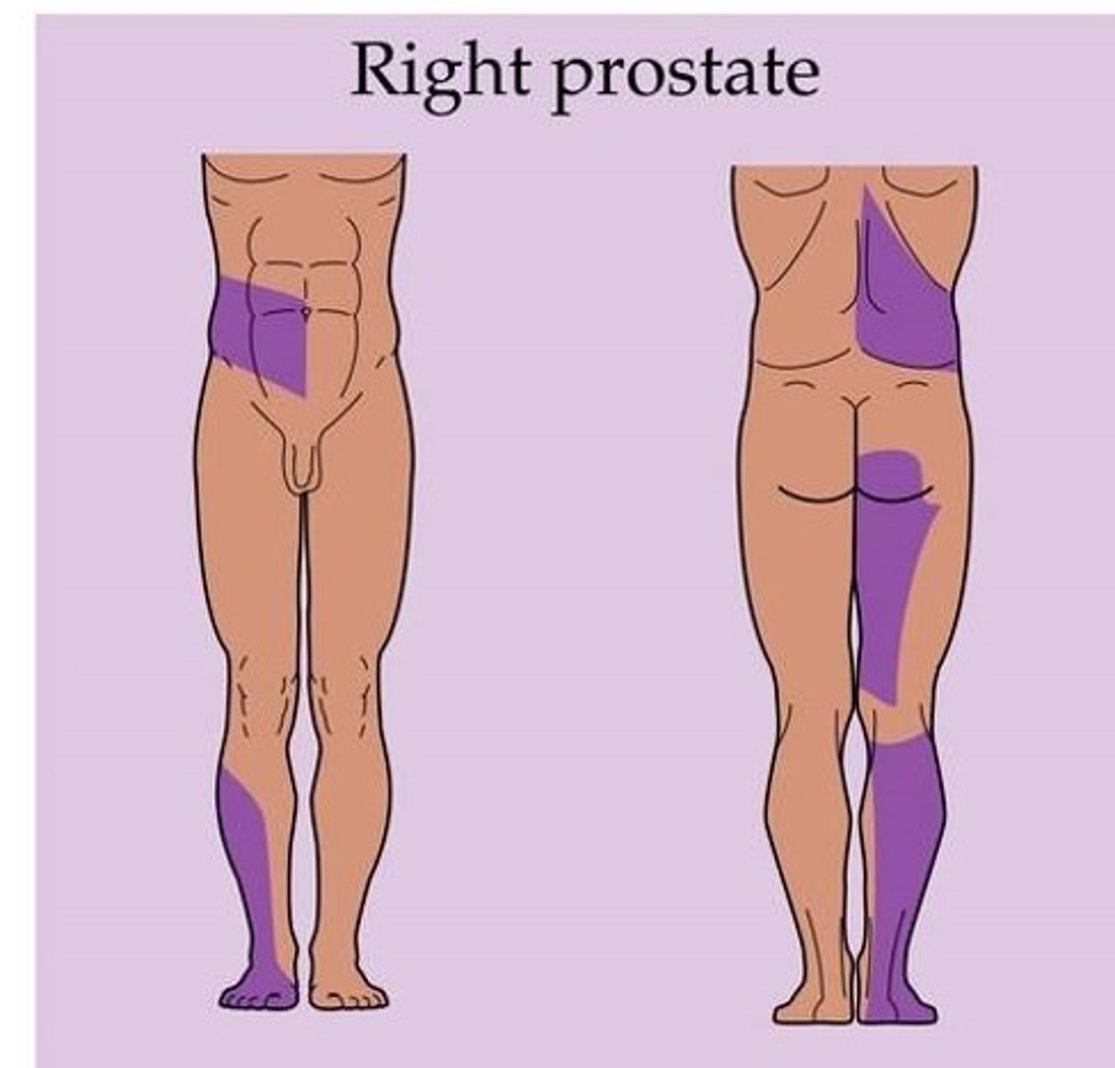 <p>referred pain of what structure?</p>