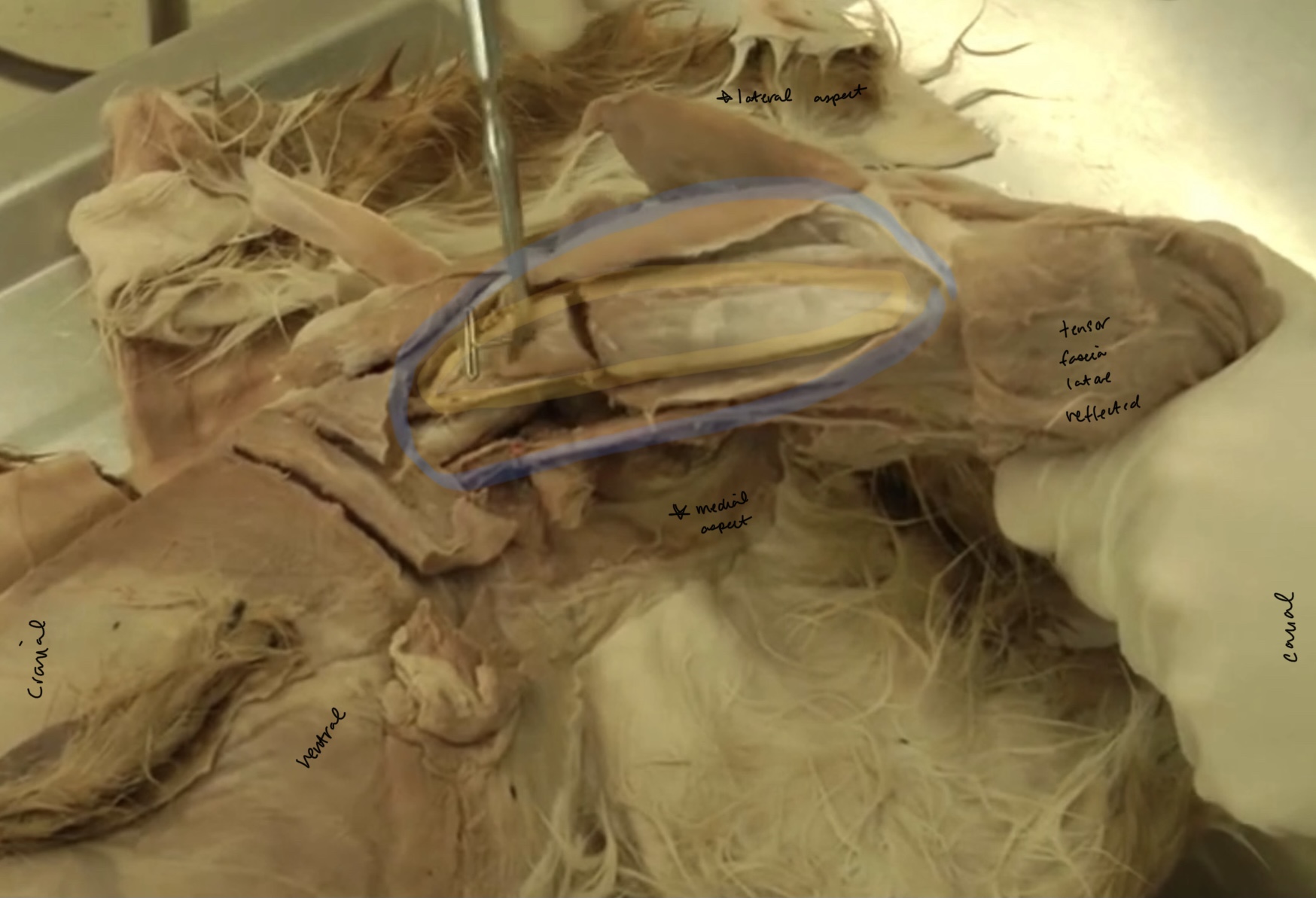 <p>What is this muscle in blue?</p>