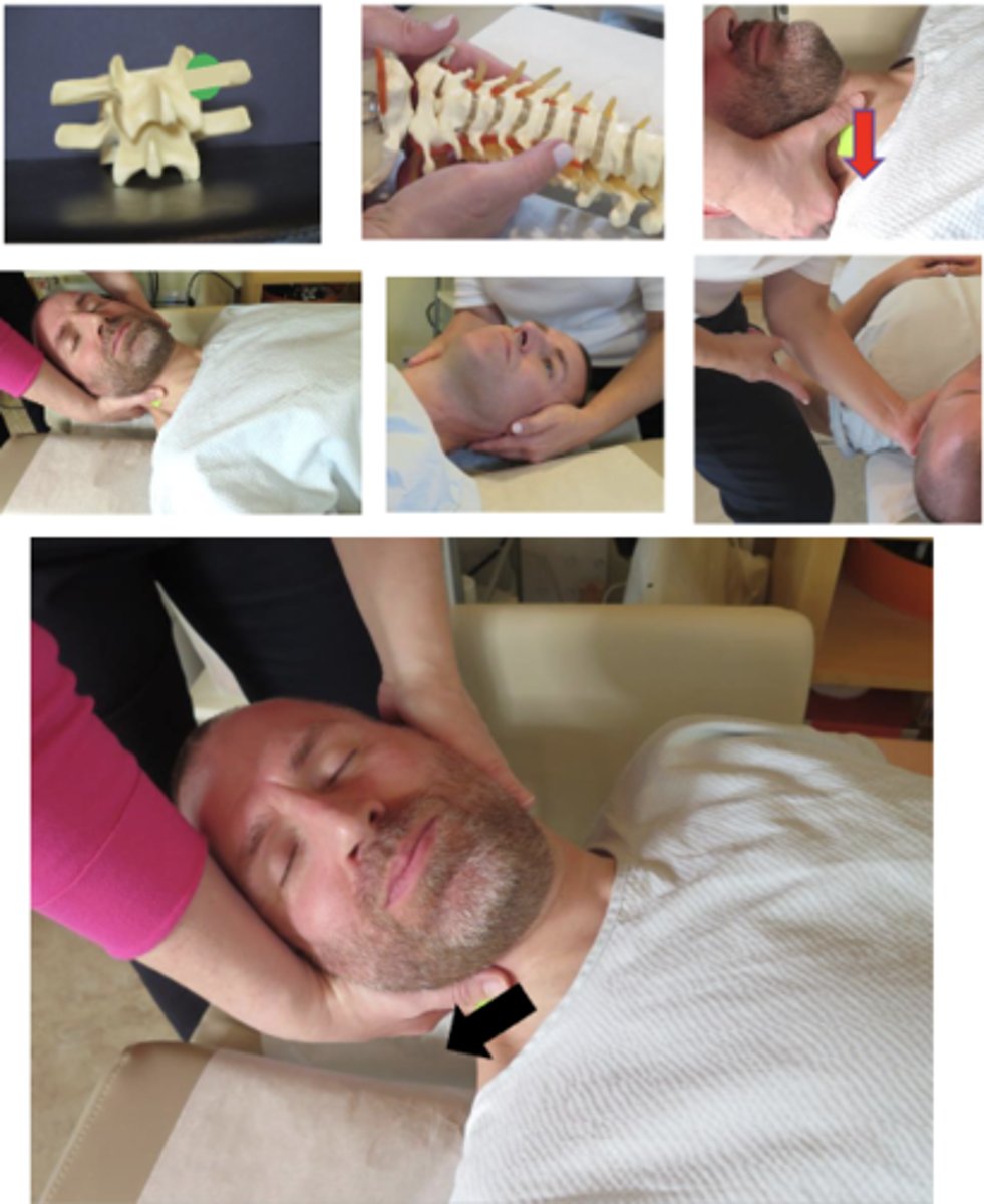 <p>• PP: Supine, ask permission to open gown/contact patient, verbalize finding the segment</p><p>• DP: Towards head of table, OPPOSITE side of contact, 45° to patient, tissue slack M-L</p><p>• CH: Palmar surface of thumb of the hand corresponding to the side of segmental contact, on anterolateral articular pillar of superior vertebrae, palm turned up, fingers supporting the occiput</p><p>• IH: Fingers cupping ear, supports contralateral occiput and upper cervical spine</p><p>• VEC: A-P and slight I-S inducing clockwise rotation (or counterclockwise rotation depending on the direction)</p>