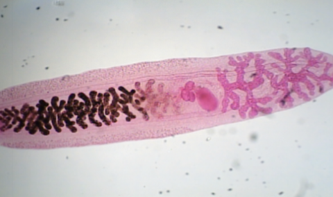 <p>Clonorchis sinesis </p>