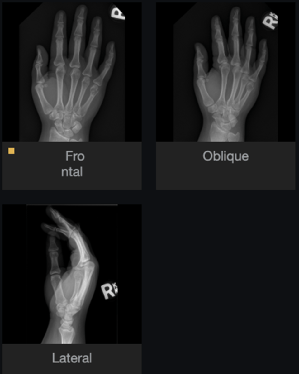 <p>Describe the lesion</p>