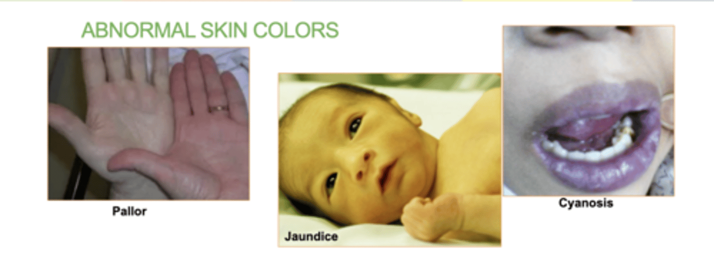 <p>Pallor, Jaundice, Cyanosis</p>