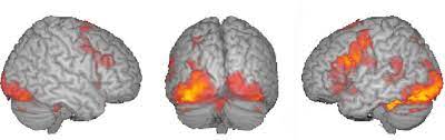 <p>fMRI</p>