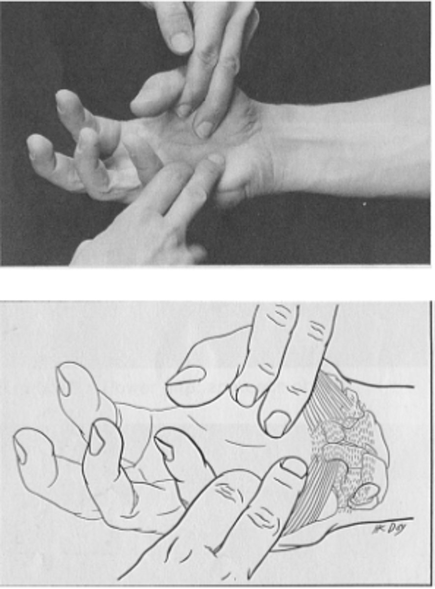 <p>Rögzítés: mutatóujjam a tenyérbe</p><p>Hüvelykujját és kisujját közelítse, tenyér közepe táján érjen össze.</p><p>Ellenállás: I., V. metacarpus fejecse</p>