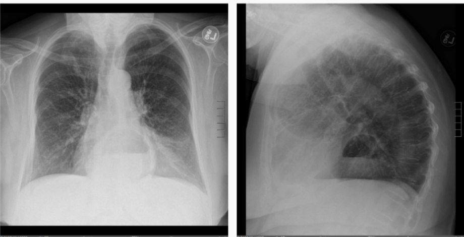<p>What is this patient presenting with?</p>