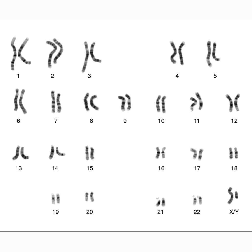 <p>What gender is this (karyotype)?</p>