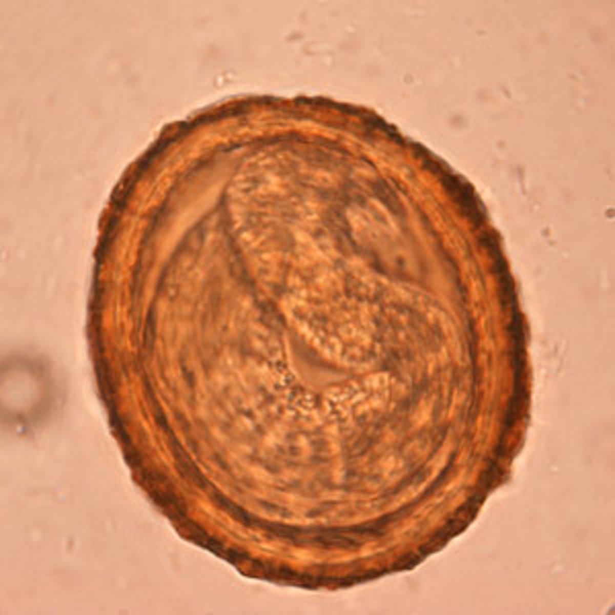 <p>Baylisascaris procyonis</p>