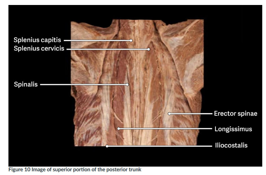 <ol start="12"><li><p>Splenius</p></li></ol><p></p>