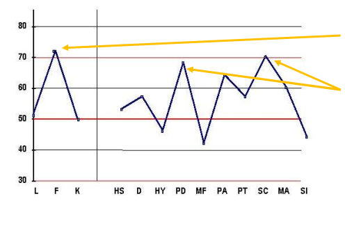 <ul><li><p>Check validity scales High F scale </p></li><li><p>Identify peaks (T&gt;65) PD &amp; SC scales </p></li><li><p>Inspect ‘atlas’ for profile code 48 code</p></li></ul><p></p>