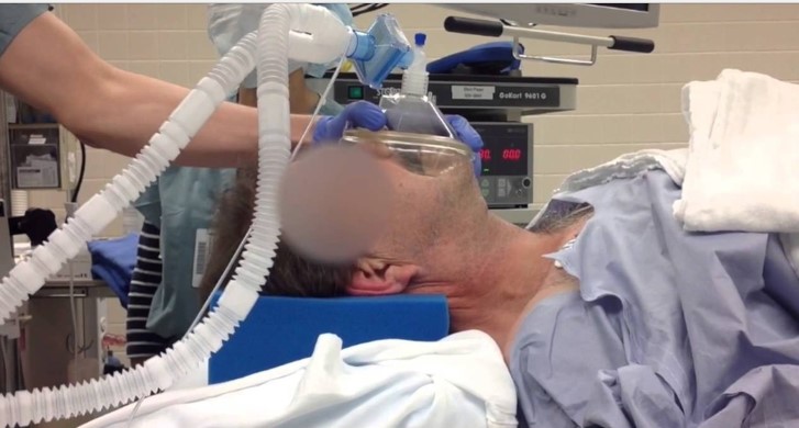   When to use it?

•It’s most commonly used between induction and intubation

•But it can also be used if a patient is obstructing with a non-invasive  airway device (e.g. during a MAC procedure)

•Also during CPRwithout a “secured airway”