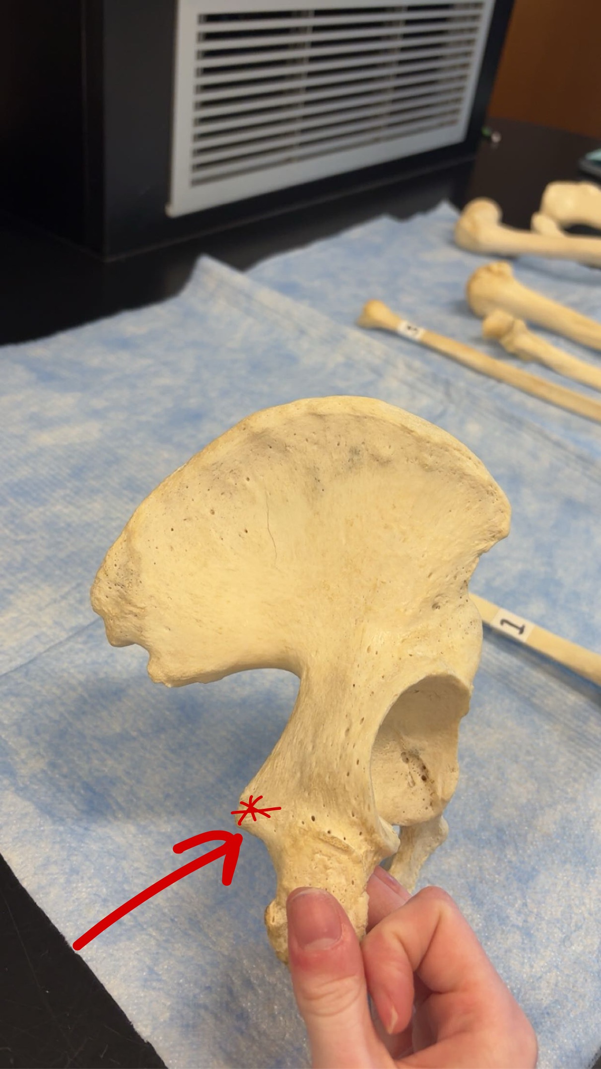 <p>Name this structure</p>