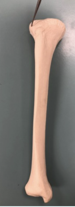 <p><span style="font-family: -apple-system, system-ui, Segoe UI, Roboto, Helvetica Neue, Arial, Noto Sans, Liberation Sans, sans-serif, Apple Color Emoji, Segoe UI Emoji, Segoe UI Symbol, Noto Color Emoji">Identify this feature.&nbsp;</span></p>